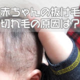 赤ちゃんの抜け毛切れ毛の原因は？