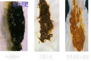 【胎便】ママびっくり！赤ちゃんの初めてのうんちが黒い理由 | 育児ログ